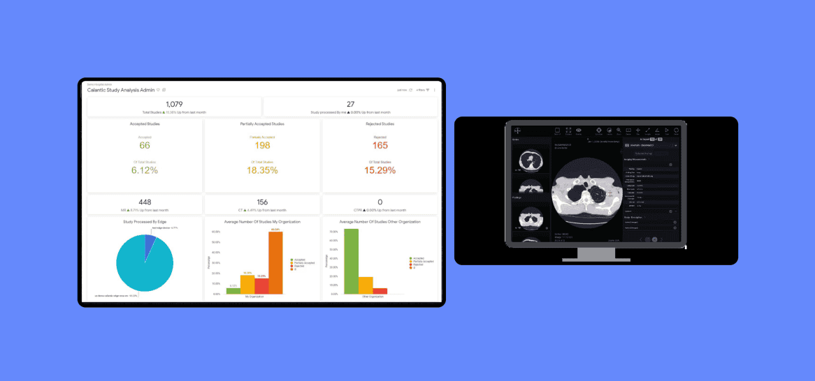 Increased capacity to build and maintain AI radiology software cover image
